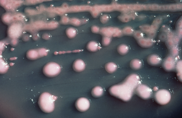 Diario HOY | Describen cómo una mujer superó una infección bacteriana multirresistente