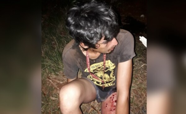 Joven en situación de calle es encontrado con disparos en la pierna