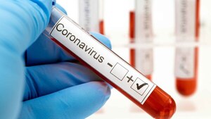 Nuevo récord de contagios: 6.760 positivos y 21 fallecidos por COVID-19