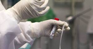 La Nación / COVID-19: recomiendan priorizar pruebas rápidas de antígenos ante síntomas