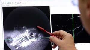 Mujer británica recupera su visión tras recibir primer implante de un chip biónico