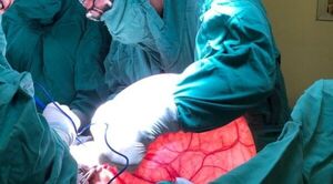 Extraen tumor de 15 kilos del ovario de una mujer en el Hospital Nacional