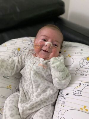 Candela cumplió dos meses y aguarda su siguiente cirugía - Nacionales - ABC Color