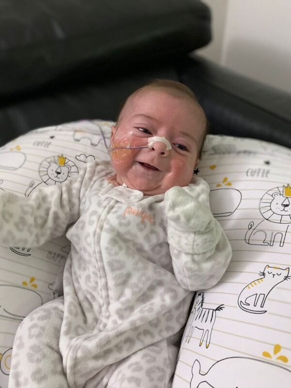 Candela cumplió dos meses y aguarda su siguiente cirugía - Nacionales - ABC Color