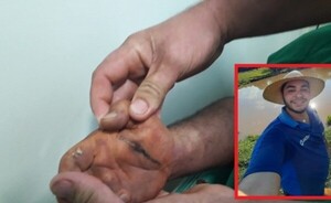 Agricultor cae electrocutado por cable de alta tensión