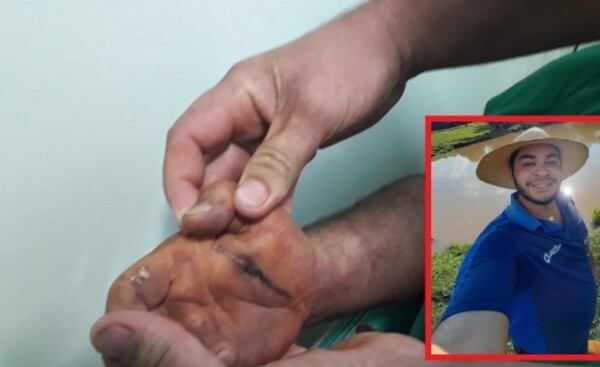 Agricultor cae electrocutado por cable de alta tensión
