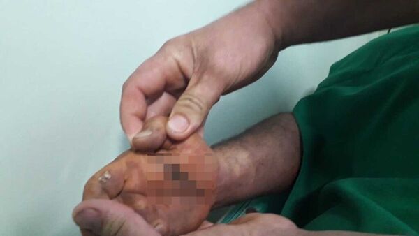 Quiso evitar más incendios de cañaveral y murió electrocutado