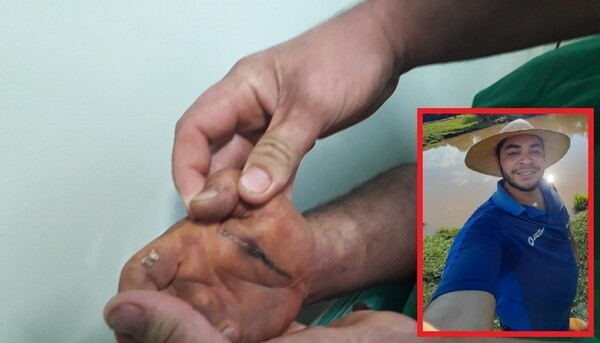 Alto Parana: Agricultor cae electrocutado por cable de alta tensión