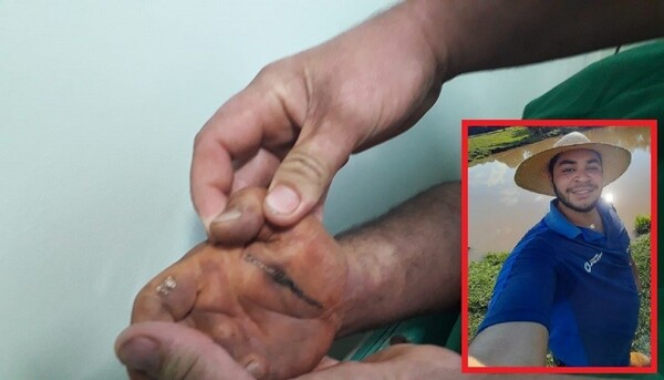 Alto Parana: Agricultor cae electrocutado por cable de alta tensión