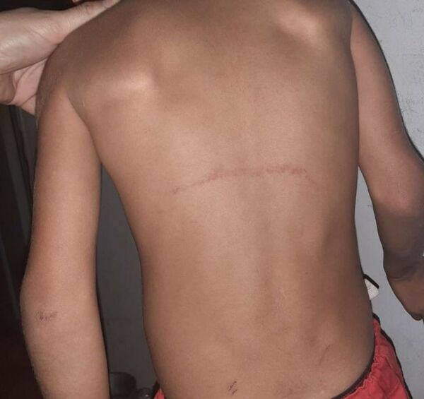 Garroteó a su hijo de 7 años y le dejó llorando en la calle