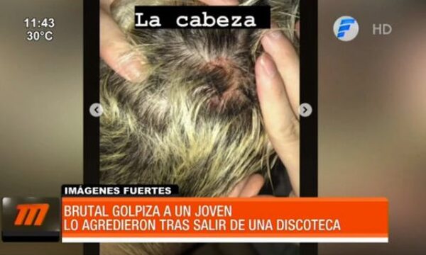 Denuncian brutal agresión a un joven frente a una discoteca | Telefuturo