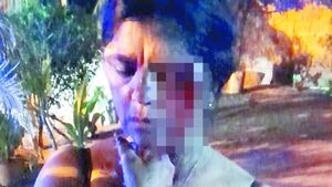 Concubino le reventó la cara y ella no quiso que le apresen