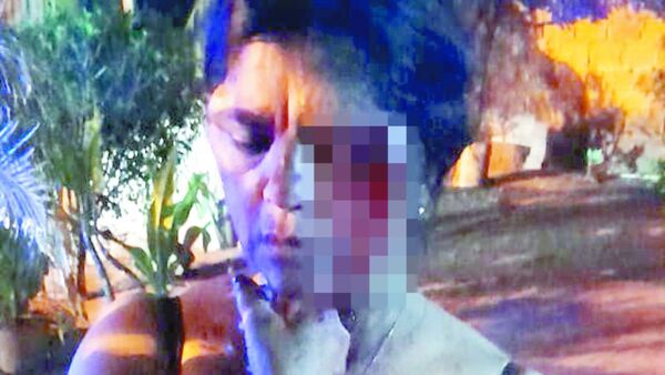 Concubino le reventó la cara y ella no quiso que le apresen