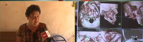 Crónica / Solicita hace años que el IPS la opere para que le quiten un tumor, pero...