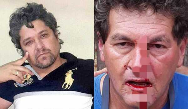 Sujeto que atacó a funcionarios de la ANDE cuenta con 14 antecedentes - La Clave
