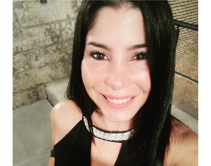 Exmodelo murió a causa de una hemorragia durante cirugía estética