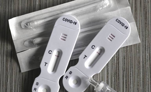 Diario HOY | Agencia sanitaria brasileña aprueba los autotest contra el covid-19