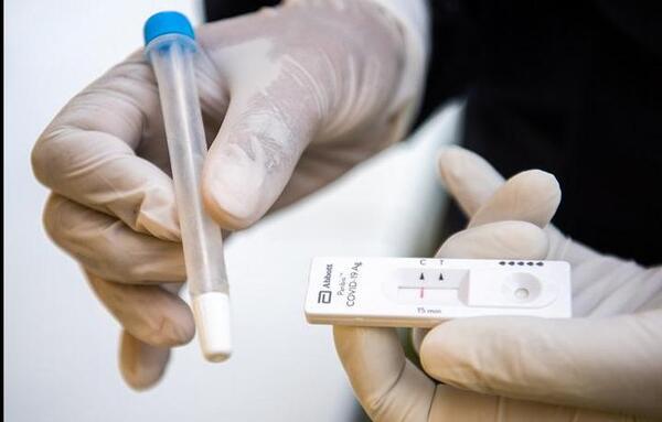 Brasil: aprueban autotest para venta en Farmacia, tras avance de Ómicron