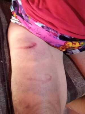 Rescatan a anciana torturada por su propio hijo
