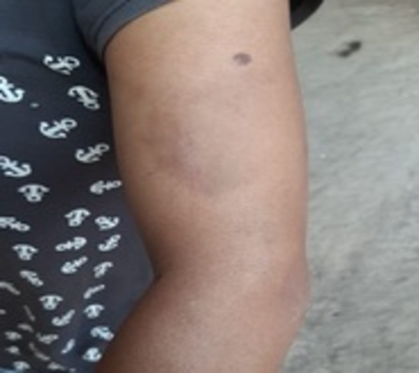 Recatan a joven que era retenida y víctima de violencia en el Chaco - Paraguay.com