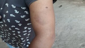 Rescatan a joven que era retenida y víctima de violencia en Chaco paraguayo | Noticias Paraguay