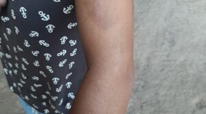 Rescatan a embarazada que era violentada por su pareja