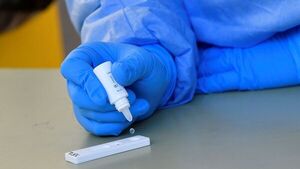 Covid-19: Central libera el test de antígeno en servicios públicos