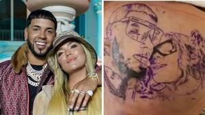 Crónica / [VÍDEO] Anuel se mandó borrar su tatuaje con "La Bichota"