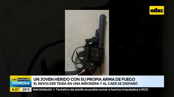 Un joven herido con su propia arma de fuego - ABC Noticias - ABC Color