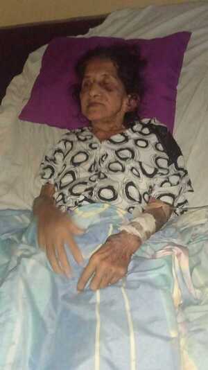 Apelan a la solidaridad para anciana golpeada por su hijo - La Clave