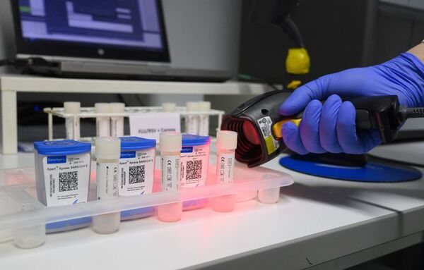 Incubación del covid sería de 42 horas - Ciencia - ABC Color