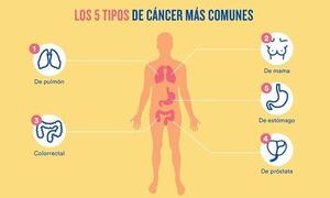 Cáncer: La detección precoz está en nuestras manos – Prensa 5