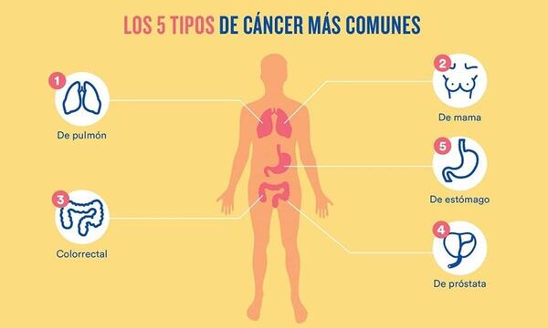 Cáncer: La detección precoz está en nuestras manos – Prensa 5