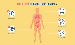Diario HOY | Día Mundial contra el Cáncer: la detección precoz es fundamental
