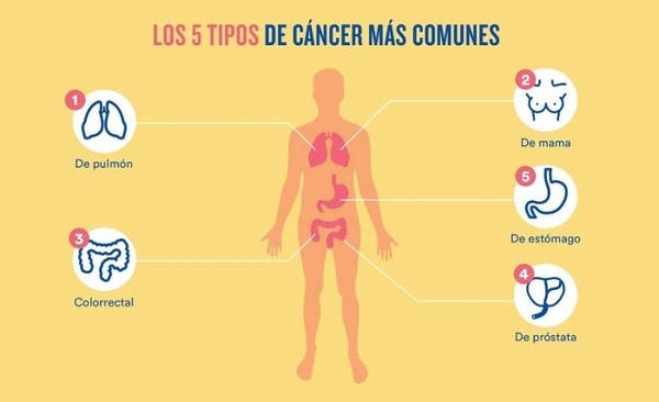 Diario HOY | Día Mundial contra el Cáncer: la detección precoz es fundamental