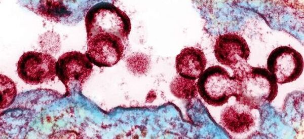 Descubren nueva variante más virulenta y transmisible del VIH