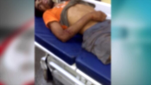 Machetearon a joven por puja amorosa, según hermano de la victima