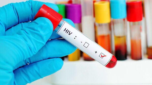 Variante más virulenta del VIH lleva décadas circulando en Países Bajos