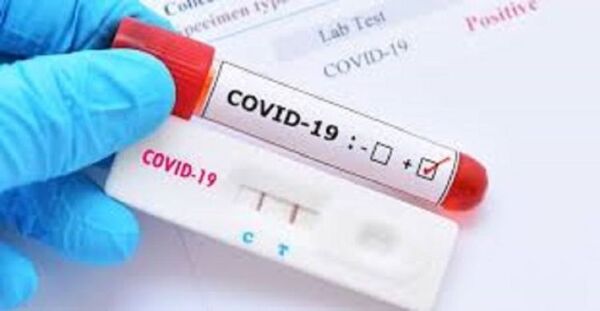 Salud reporta 47 fallecidos y 2.942 nuevos casos de Covid-19