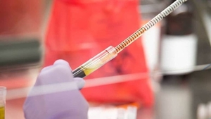 Diario HOY | Un nuevo análisis de sangre detecta qué tan grave será la infección por COVID-19