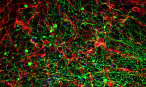 Estudio israelí busca revertir la parálisis con implantes de médula espinal - OviedoPress