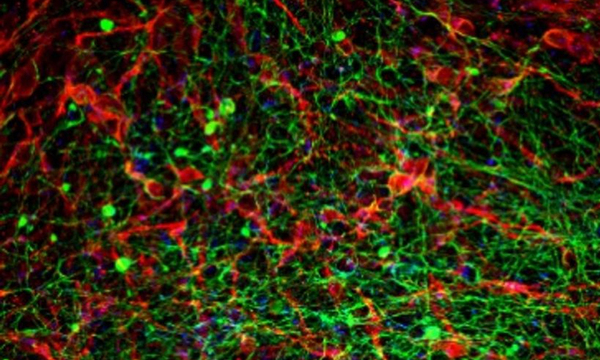 Estudio israelí busca revertir la parálisis con implantes de médula espinal - OviedoPress