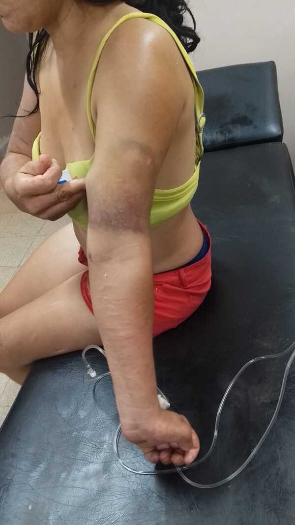 Ordenan captura de hombre que derramó aceite caliente a su pareja