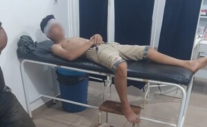 Adolescente podría perder un ojo tras ser atacado con una botella