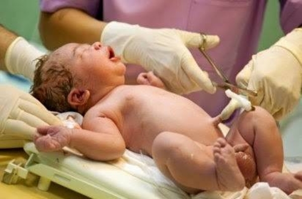 Diario HOY | Ligadura oportuna del cordón umbilical, recomendada para todos los nacimientos