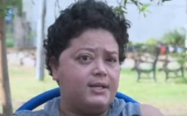 Diario HOY | Tras dos años de lucha, mujer con tumor en el rostro finalmente podrá operarse en IPS