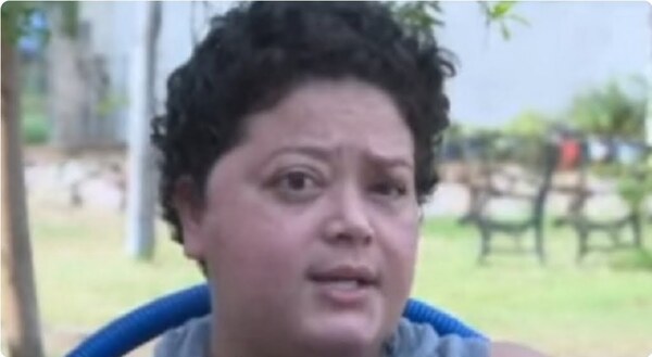 Tras dos años de lucha, mujer con tumor en el rostro finalmente podrá operarse en IPS - Noticiero Paraguay
