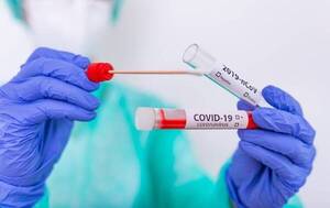 Salud reporta un descenso de contagios de Covid-19