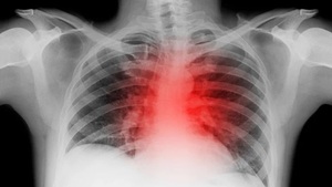 LA SOLEDAD AFECTA LA SALUD CARDIOVASCULAR EN LAS MUJERES - La Voz del Norte