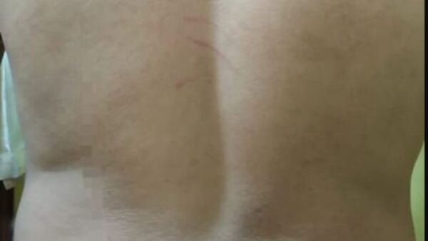 Denunció que su suegro le pegó con un sable por defender a sus perros